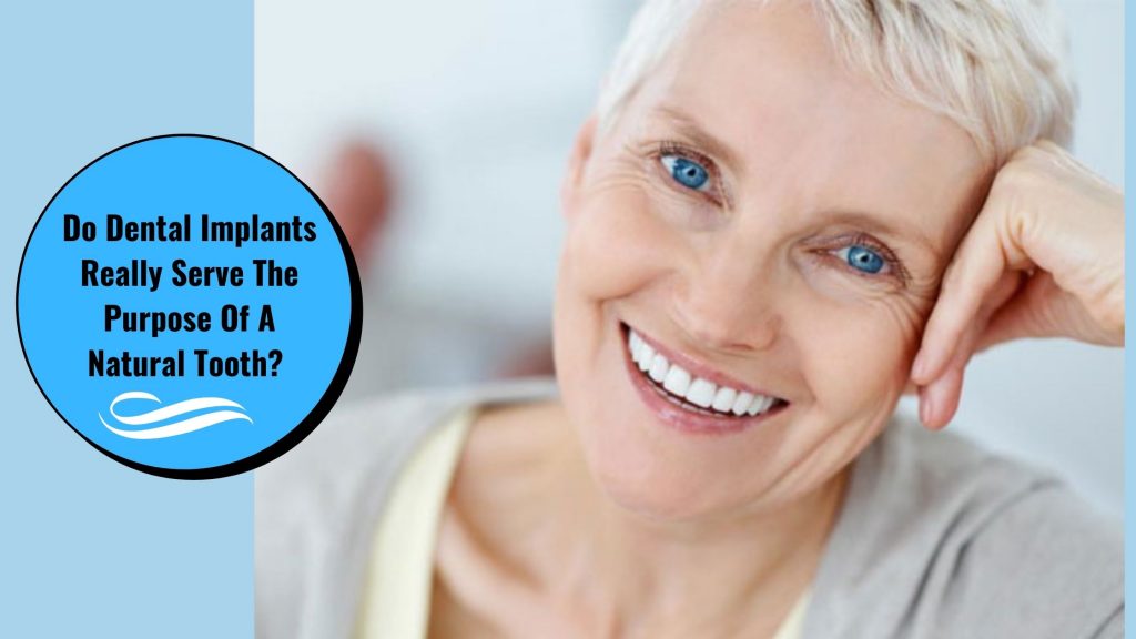 Do dental implants really serve the purpose of a natural tooth
