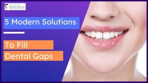 5 modern solutions to fill dental gaps