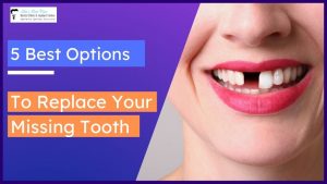 5 best options to replace your missing tooth