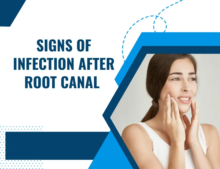 Signs of infection after root canal- blog banner image