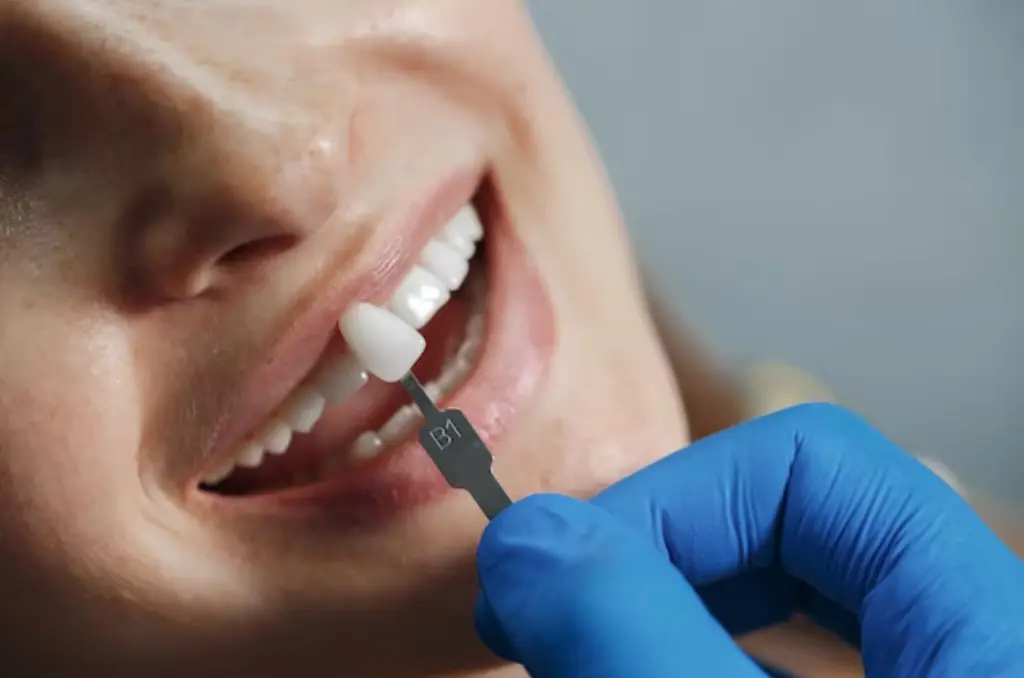 A man applying dental crown