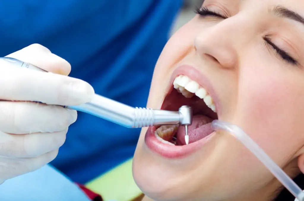 Woman applying dental bridge