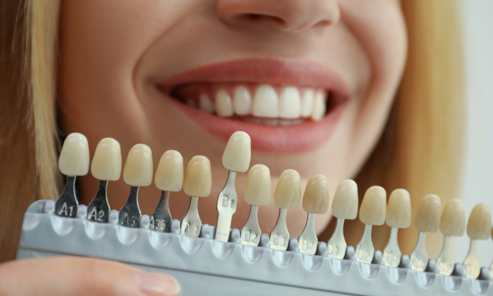 Common cosmetic dentistry procedures