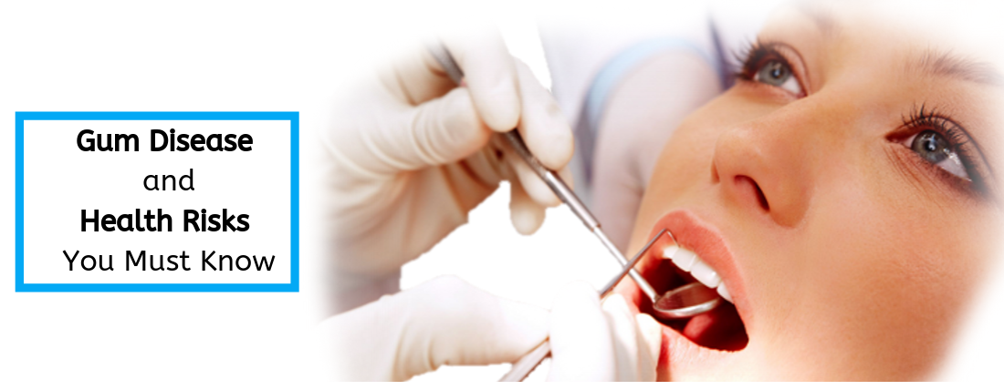 Gum disease and health risks you must know
