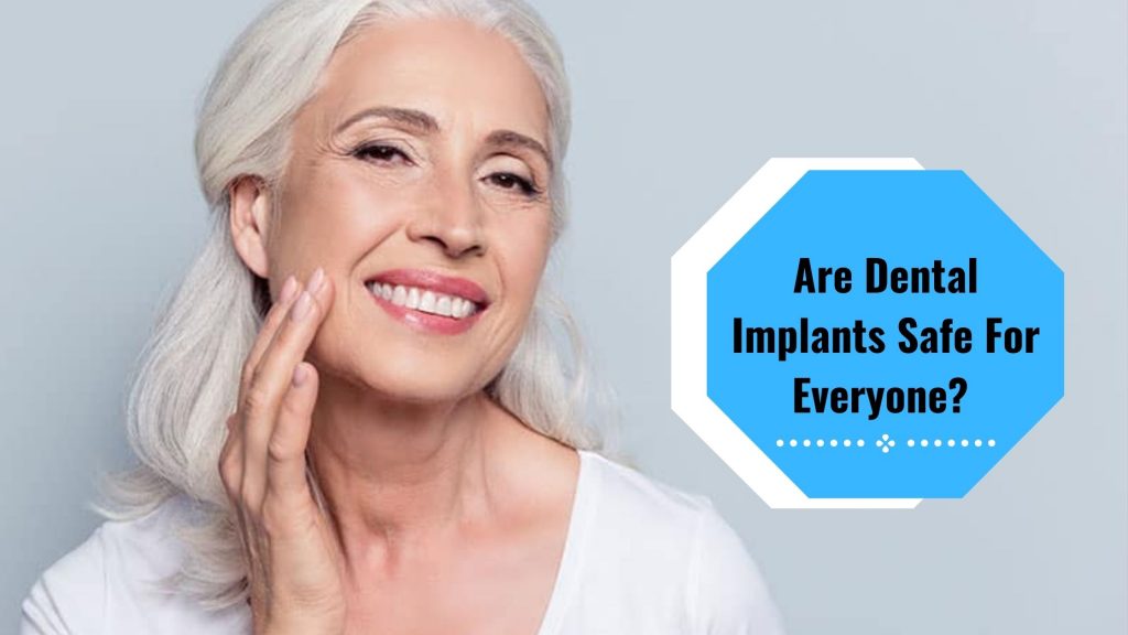 Are dental implants safe for everyone 2