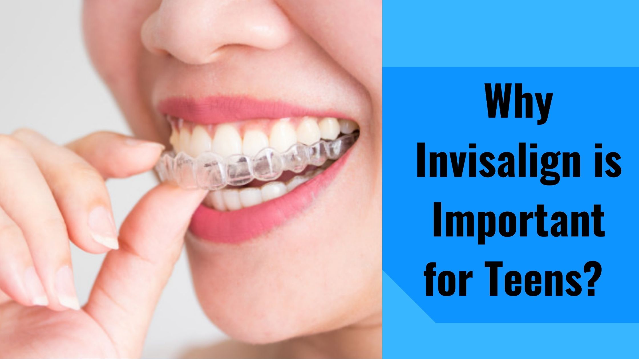 Why invisalign is important for teens