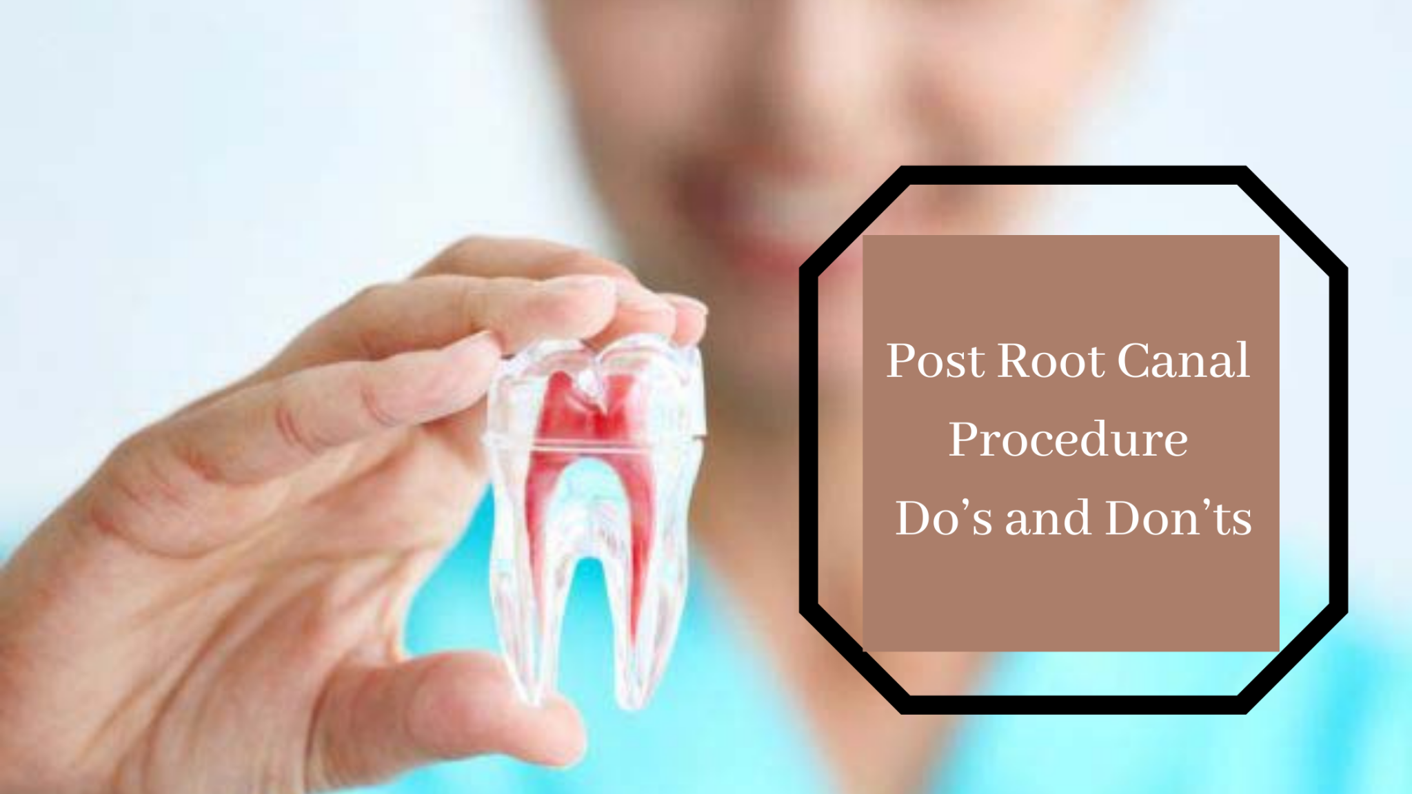 post-root-canal-procedure-do-s-and-don-ts