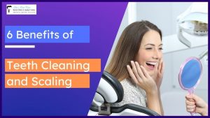 6 benefits of teeth cleaning and scaling
