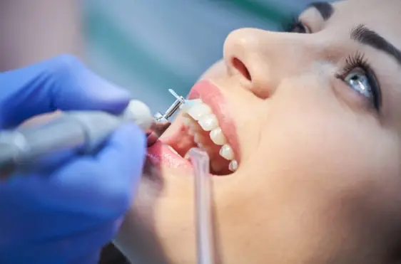Teeth scaling and polishing in pune