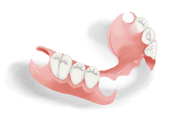 Removal- partial-dentures