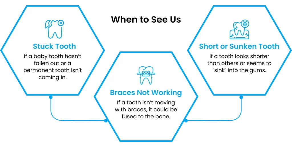 Infographic wxplaining when should you see a dentist for ankylosed teeth