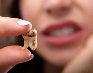 What Happens If You Ignore a Wisdom Tooth Infection?