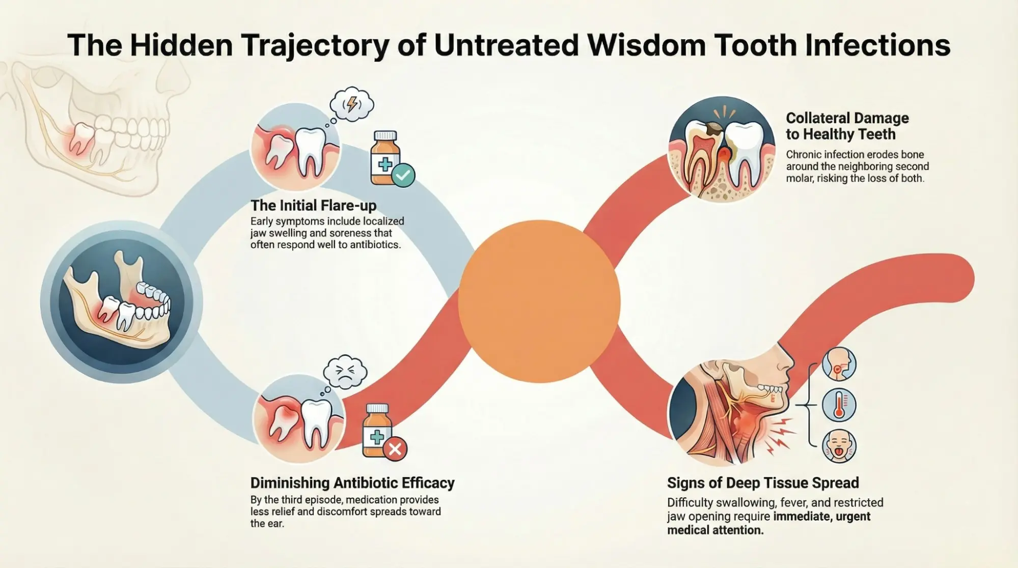 Wisdom tooth infection progression over time showing complications
