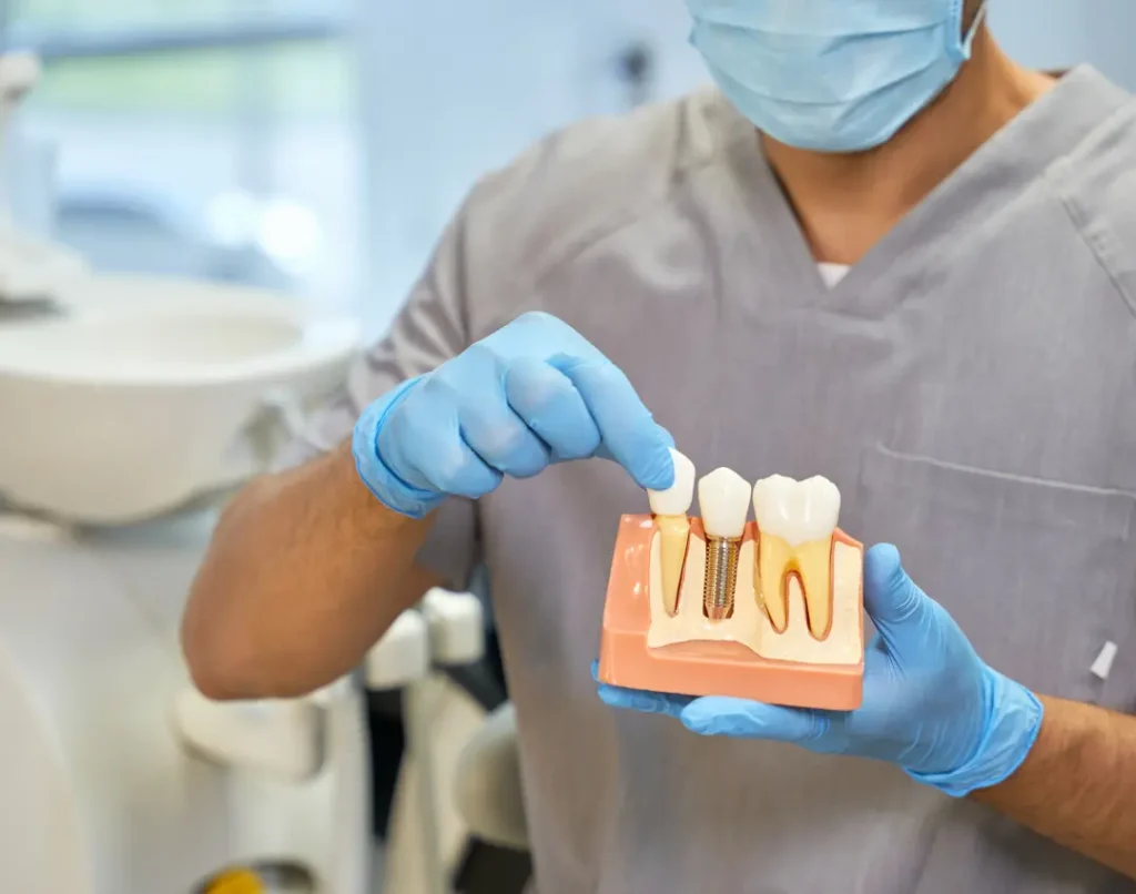 Dental Implant Immediately After Tooth Extraction
